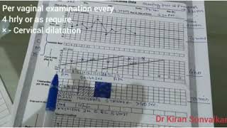Partograph  How to Use it [upl. by Lraed]
