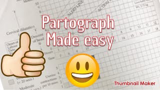 partograph made easy [upl. by Imiaj236]