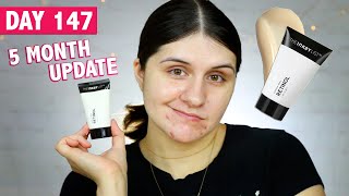 I Tried The Inkey List Retinol AntiAging Serum 5 MONTH UPDATE [upl. by Lewak]