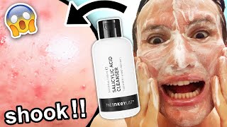 I tried the Inkey List SALICYLIC ACID CLEANSER for ONE WEEK better than cerave [upl. by Meakem673]