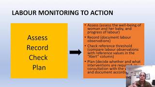 labor care guide time to change from Partogram to Labor care guide by WHO Dr Prof ArunaNigam [upl. by Gerianna]