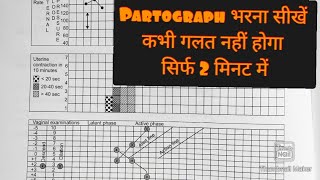 How to fill partograph with example Part3 Practical application of partograph progress of labor [upl. by Rasec355]