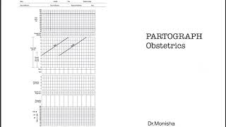 How to read a PARTOGRAPH  Obstetrics [upl. by Yaffit663]