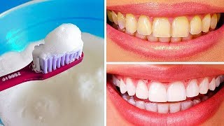 10 formas naturales de blanquear los dientes amarillentos en casa [upl. by Helbon]