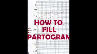 HOW TO FILL PARTOGRAM  VERY EASY [upl. by Nairred]