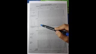 How to fill a partogram [upl. by Dearman273]